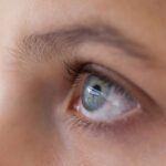 Advertising and writing about light therapy in the media: why are the eyes nearly always closed?